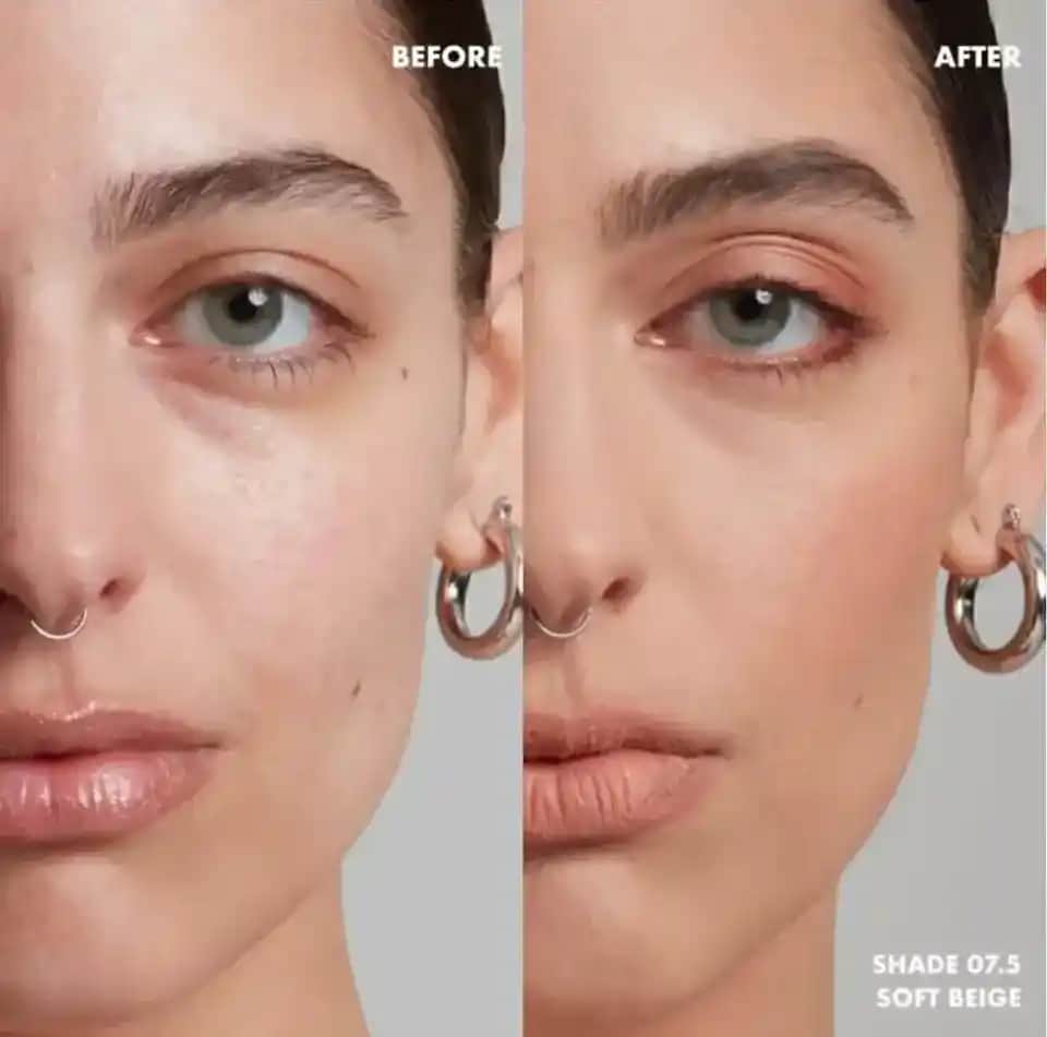 Sivilceli Ciltler İçin Fondöten Seçimi ve Uygulama Tavsiyeleri