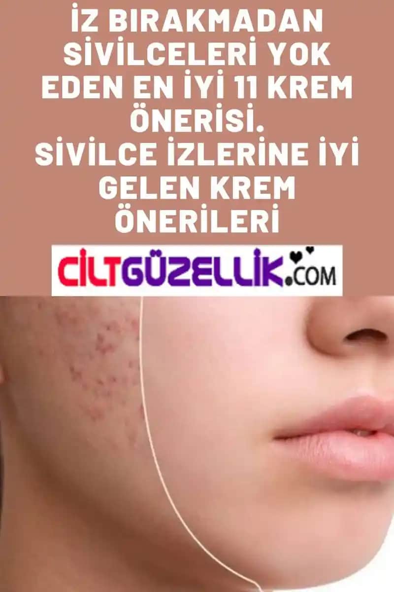 Sivilceye Yönelik Cilt Bakımı İçin Uzman Tavsiyeleri ve En Etkili Yöntemler