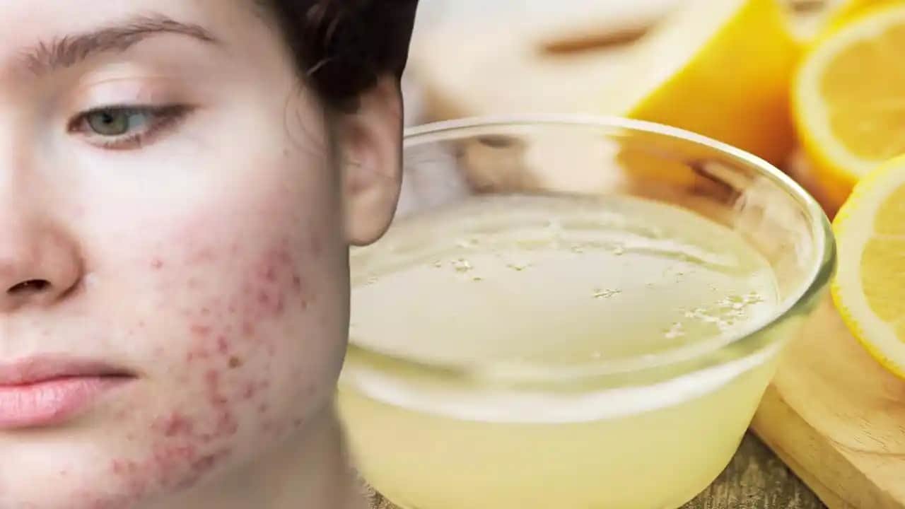 Sivilceyi Azaltan ve Giderebilen Güvenilir Yöntemler ve Doğal Çözümler