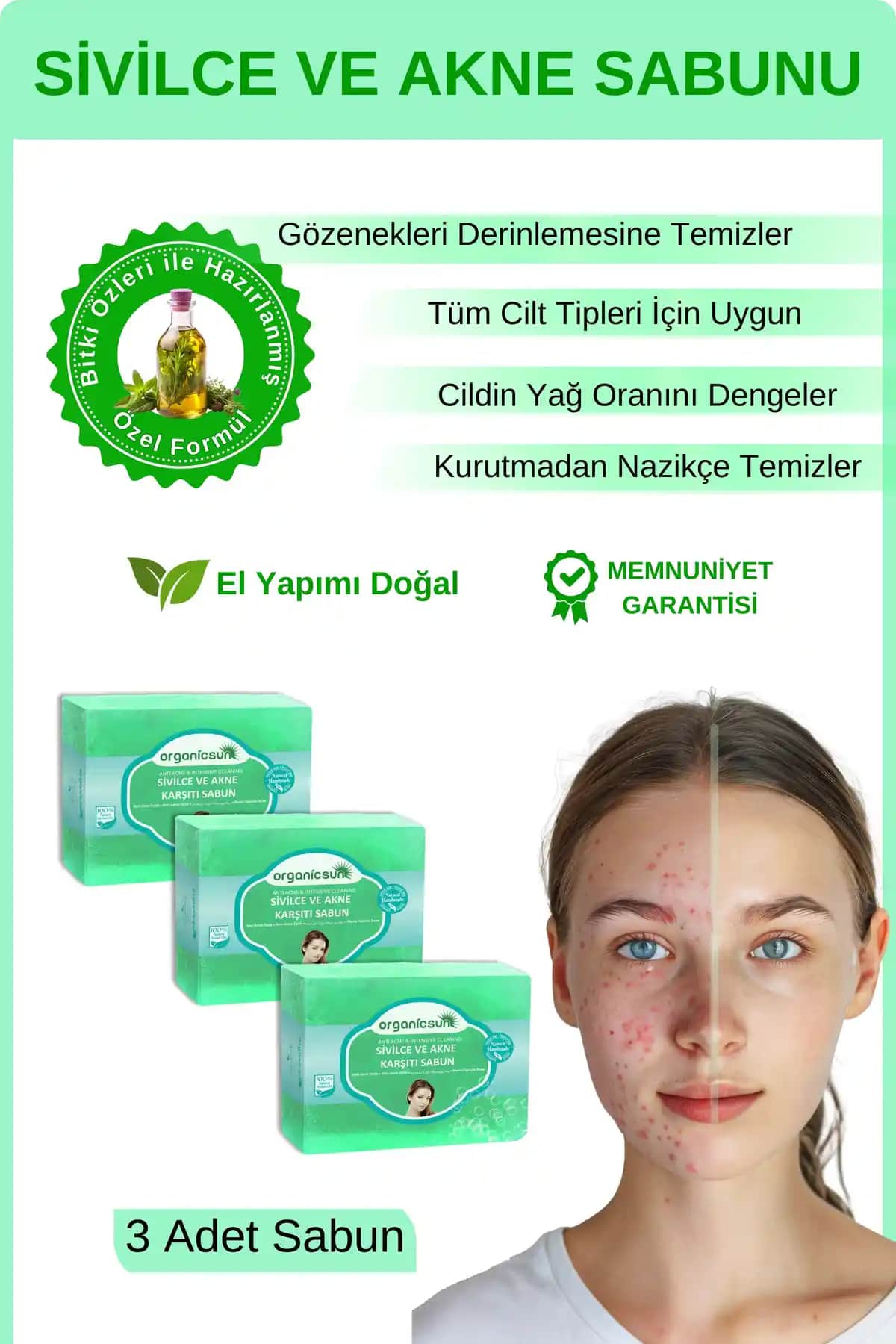 Sivilceyle Mücadelede Doğru Sabun Seçimi ve Cilt Sağlığını Koruma Yöntemleri