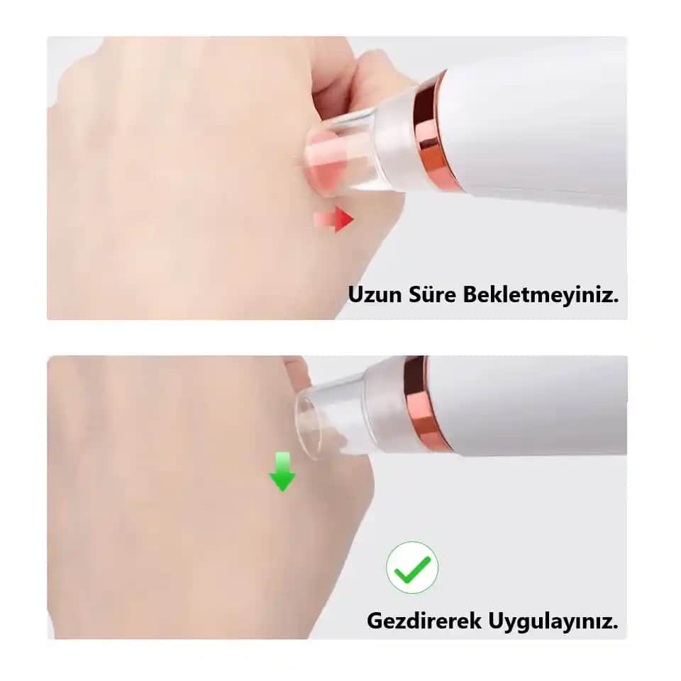 Siyah Nokta Temizleme Rehberi: Sağlıklı ve Pürüzsüz Bir Cilt İçin Etkili Yöntemler ve İpuçları