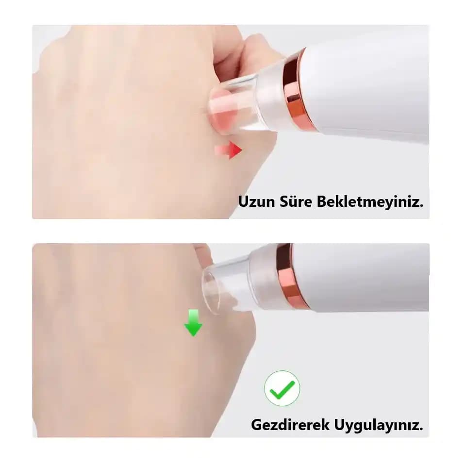 Siyah Nokta Temizleme Rehberi: Sağlıklı ve Pürüzsüz Bir Cilt İçin Etkili Yöntemler ve İpuçları