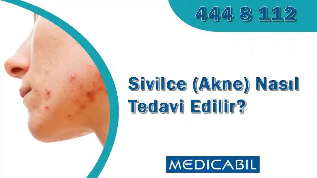 Siyah Sivilce Nedenleri ve Etkili Cilt Bakım Yöntemleri Hakkında Detaylı Bilgi