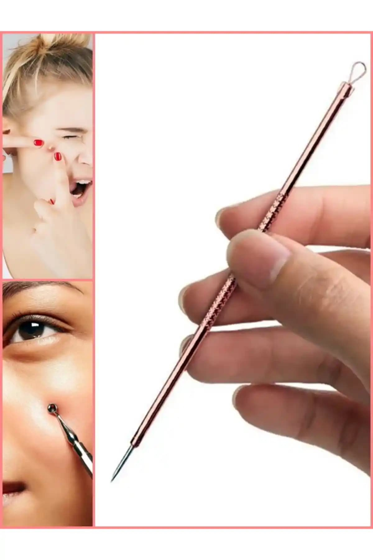 Siyah Uçlu Sivilceler: Nedenleri, Tedavi Yöntemleri ve Cilt Sağlığı İpuçları