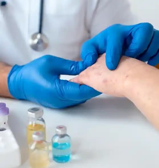 Stres Bağlantılı Egzama ve Etkili Tedavi Yöntemleri