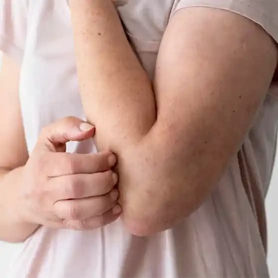 Strese Bağlı Egzama Türleri ve Stresin Cilt Sağlığı Üzerindeki Etkileri