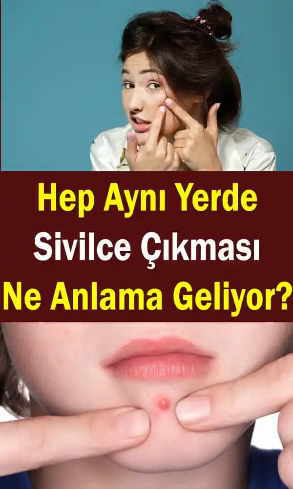 Sürekli Aynı Bölgede Çıkan Sivilceler: Nedenleri ve Etkili Çözüm Yöntemleri