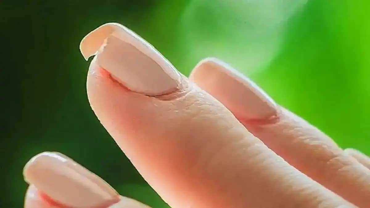 Sürekli Tırnak Kırılması Nedenleri ve Etkili Bakım Yöntemleri