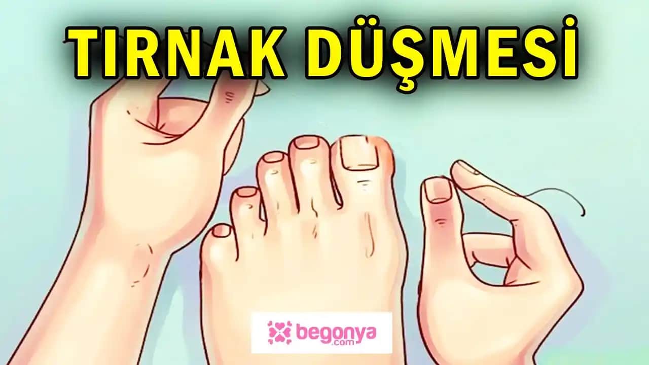Tırnak Düşmesi Nedenleri ve Güçlendirme Yöntemleri Hakkında Kapsamlı Bilgi