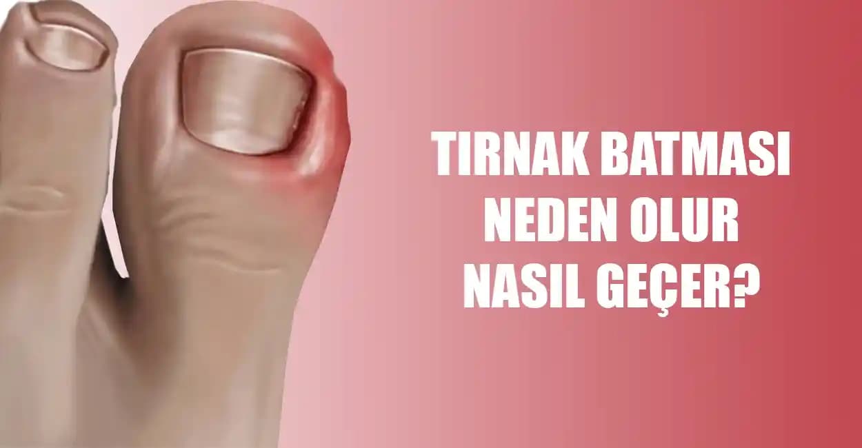 Tırnak İncelmesinin Nedenleri ve Sağlıklı Tırnaklar İçin Alınabilecek Önlemler