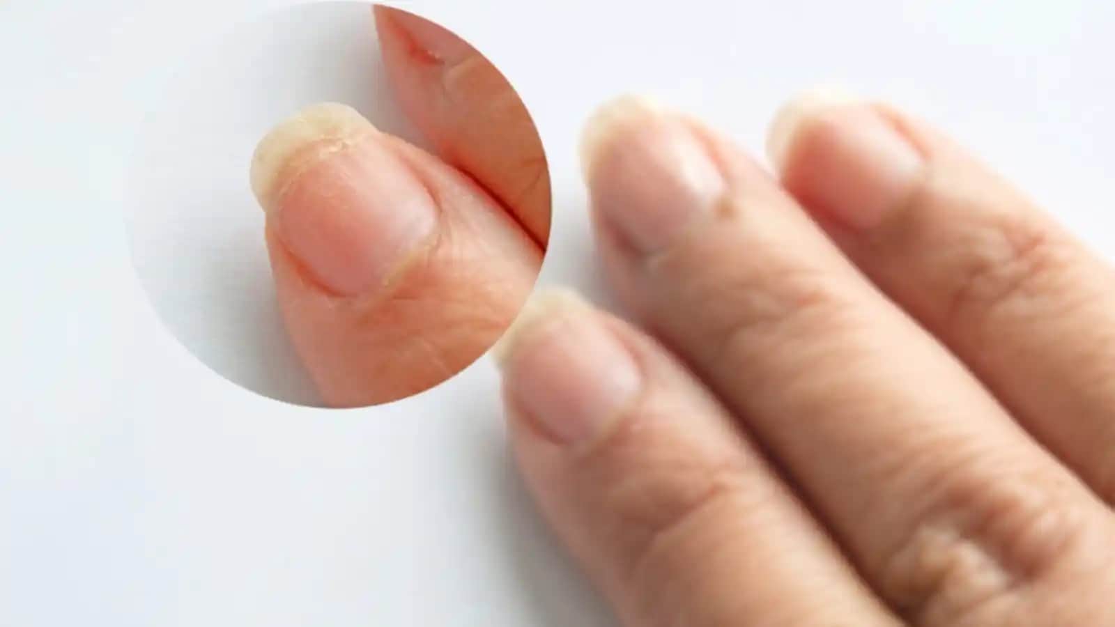 Tırnak Kırılmasını Önleyen Etkili Bakım ve Güçlendirme Yöntemleri