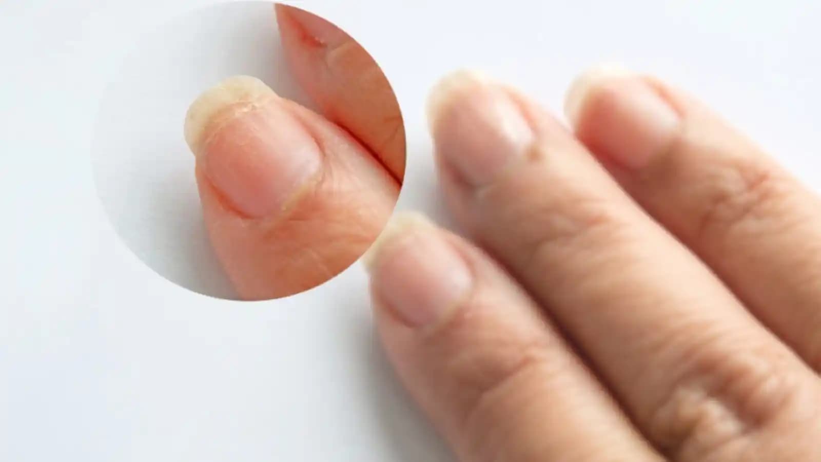 Tırnak Kırılmasını Önleyen Etkili Bakım ve Güçlendirme Yöntemleri