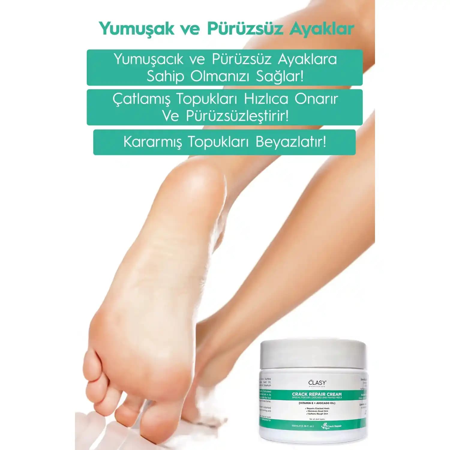 Topuk Ağrısı Nedenleri ve En Etkili Kremlerle Rahatlama Yöntemleri