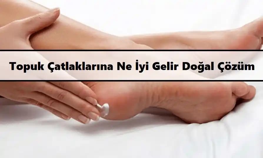 Topuk Çatlamasına Karşı Etkili Çözüm Yöntemleri ve Bakım İpuçları