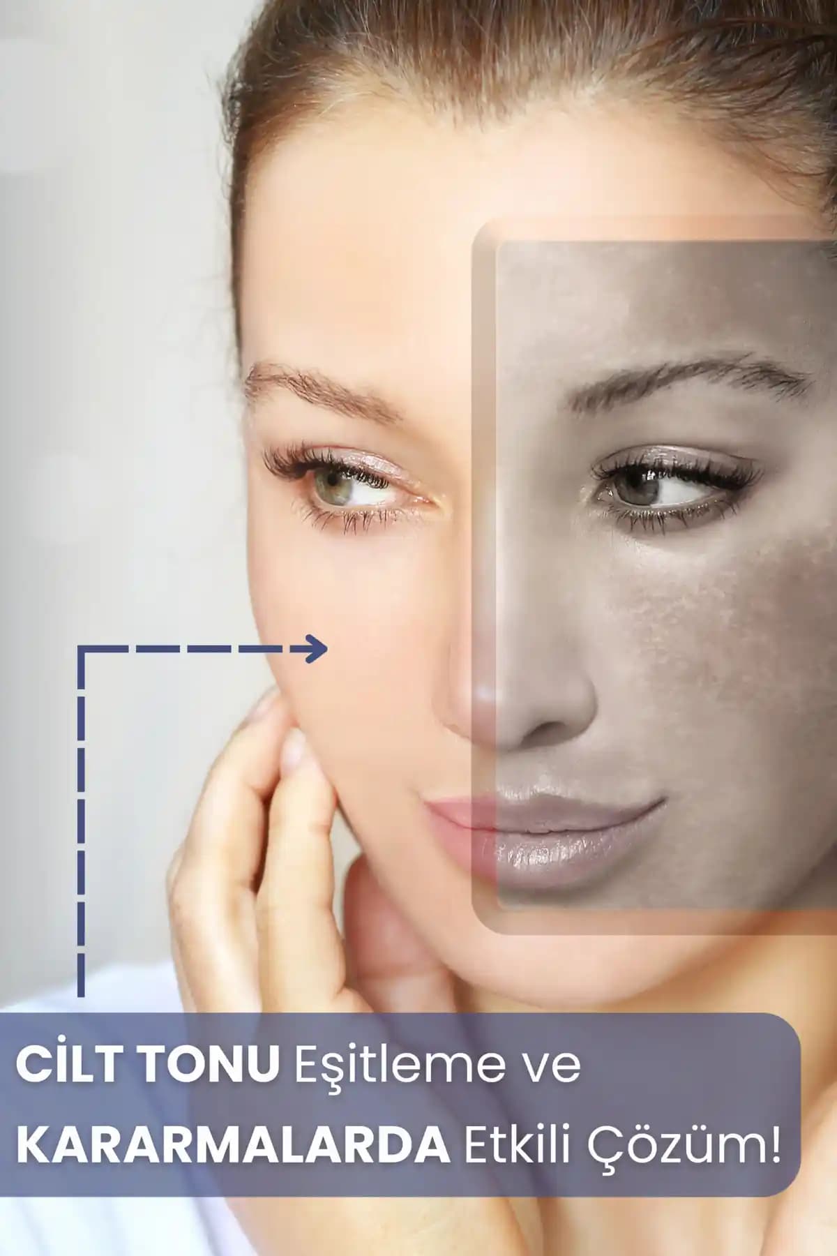 Vücut Leke Tedavisi Yöntemleri ve Doğal Çözümlerle Sağlıklı Cilde Ulaşın