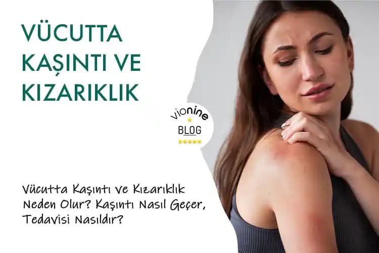 Vücutta Benek Benek Kızarıklıkların Nedenleri ve Etkili Tedavi Yöntemleri