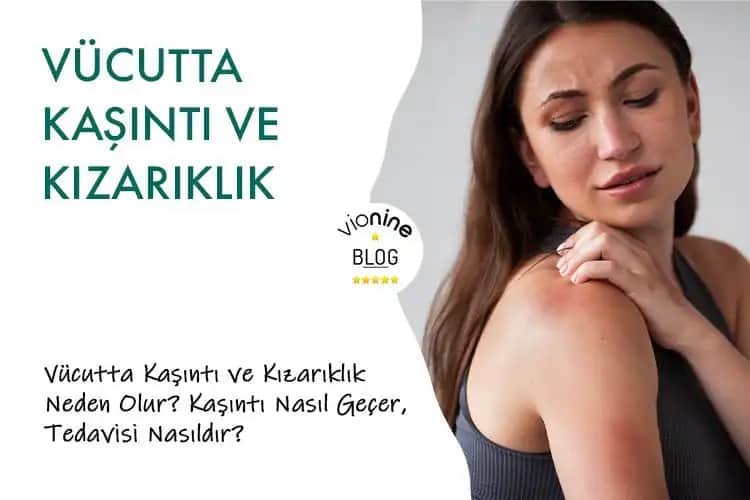 Vücutta Geçmeyen Kızarıklıklar ve Kozmetik Yaklaşımlarla Çözüm Yolları