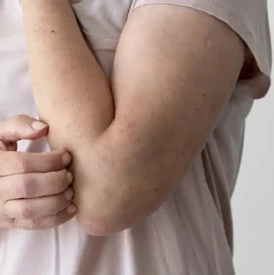 Vücutta Kaşıntılı Sivilceler: Nedenleri, Belirtileri ve Çözüm Yolları