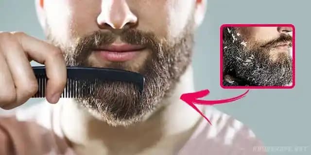 Vücutta Kepeklenme Nedenleri ve Kozmetik Çözümler Hakkında Detaylı Bilgi