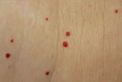 Vücutta Kırmızı Noktalar: Nedenleri, Kozmetik Çözüm Yolları ve Günlük Bakım İpuçları
