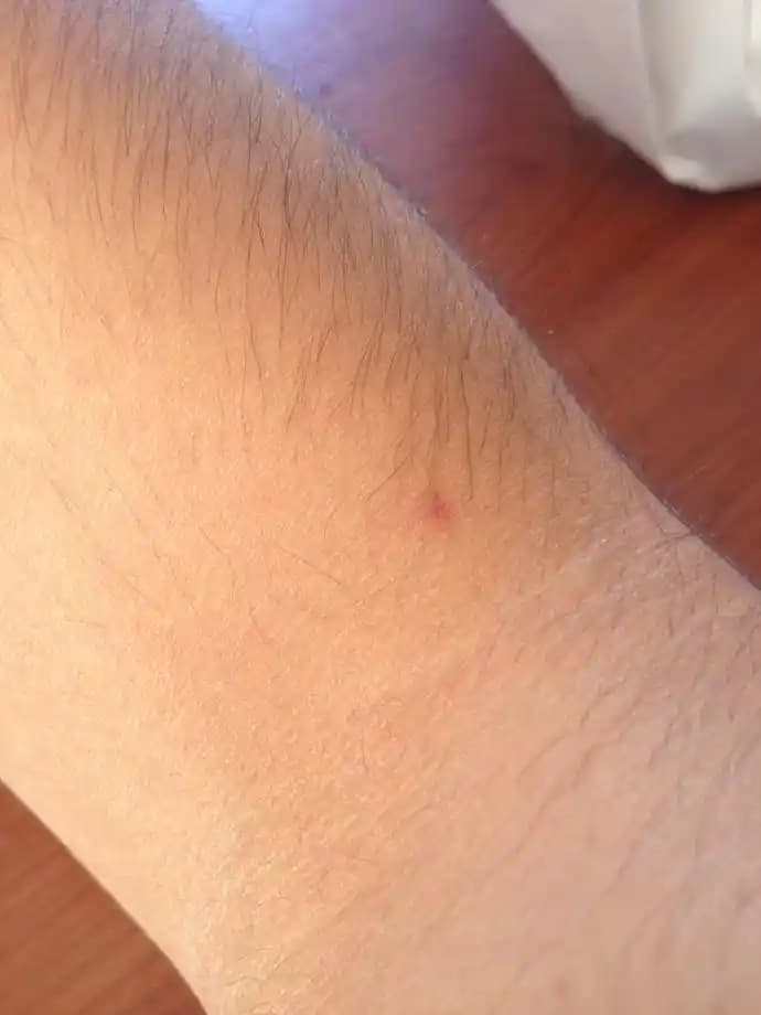 Vücutta Lekeler Çıkmasının Nedenleri ve Etkili Bakım Yöntemleri