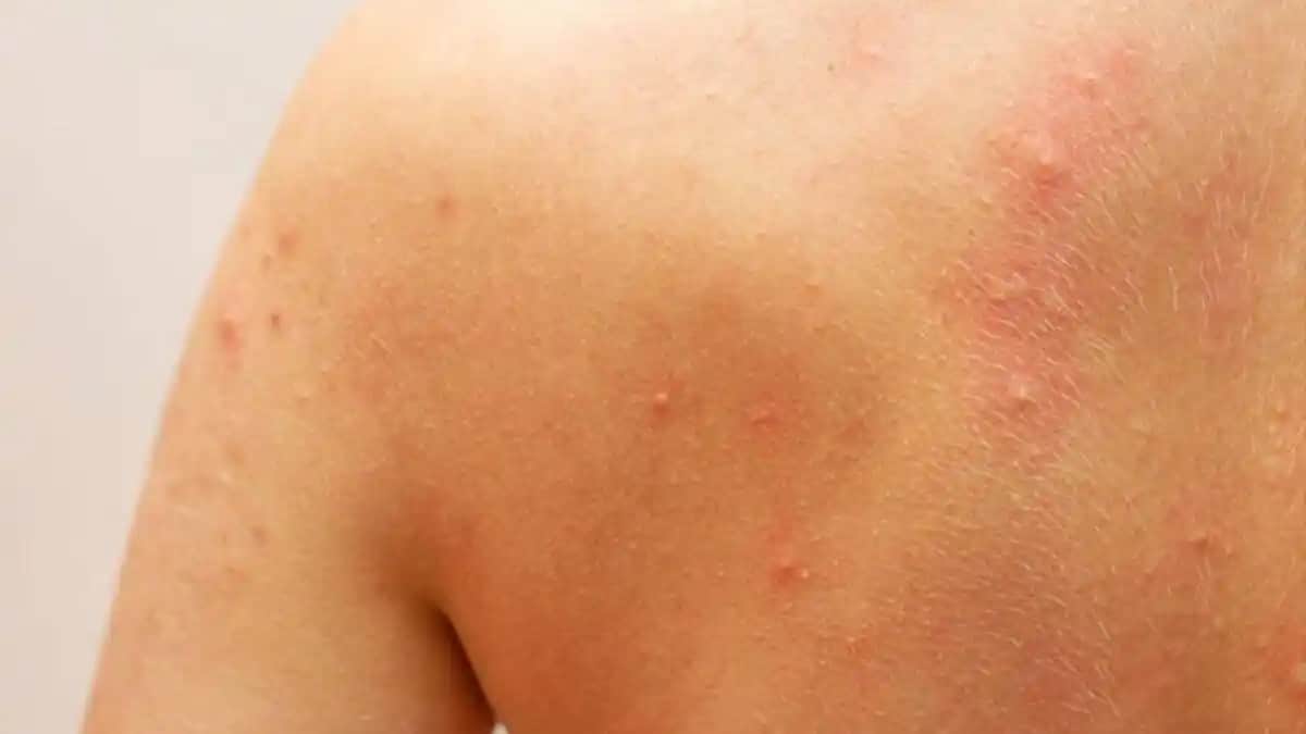 Vücutta Yaralar ve Kaşıntı Sorunları: Kozmetik Ürünlerinin Rolü ve Alınabilecek Önlemler