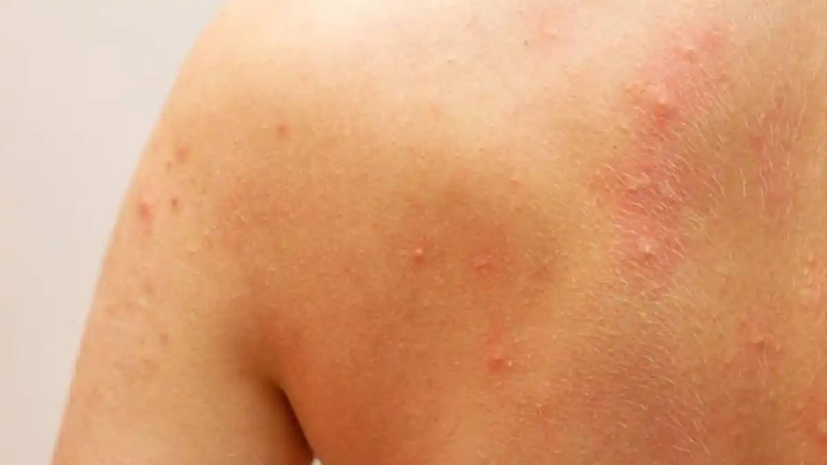 Vücutta Yaralar ve Kaşıntı Sorunları: Kozmetik Ürünlerinin Rolü ve Alınabilecek Önlemler