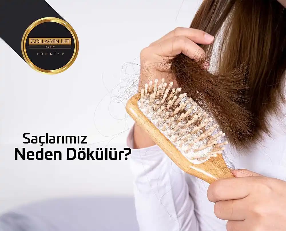 Yağlı Saç Dökülmesinin Nedenleri ve Saç Sağlığını Koruma Yöntemleri