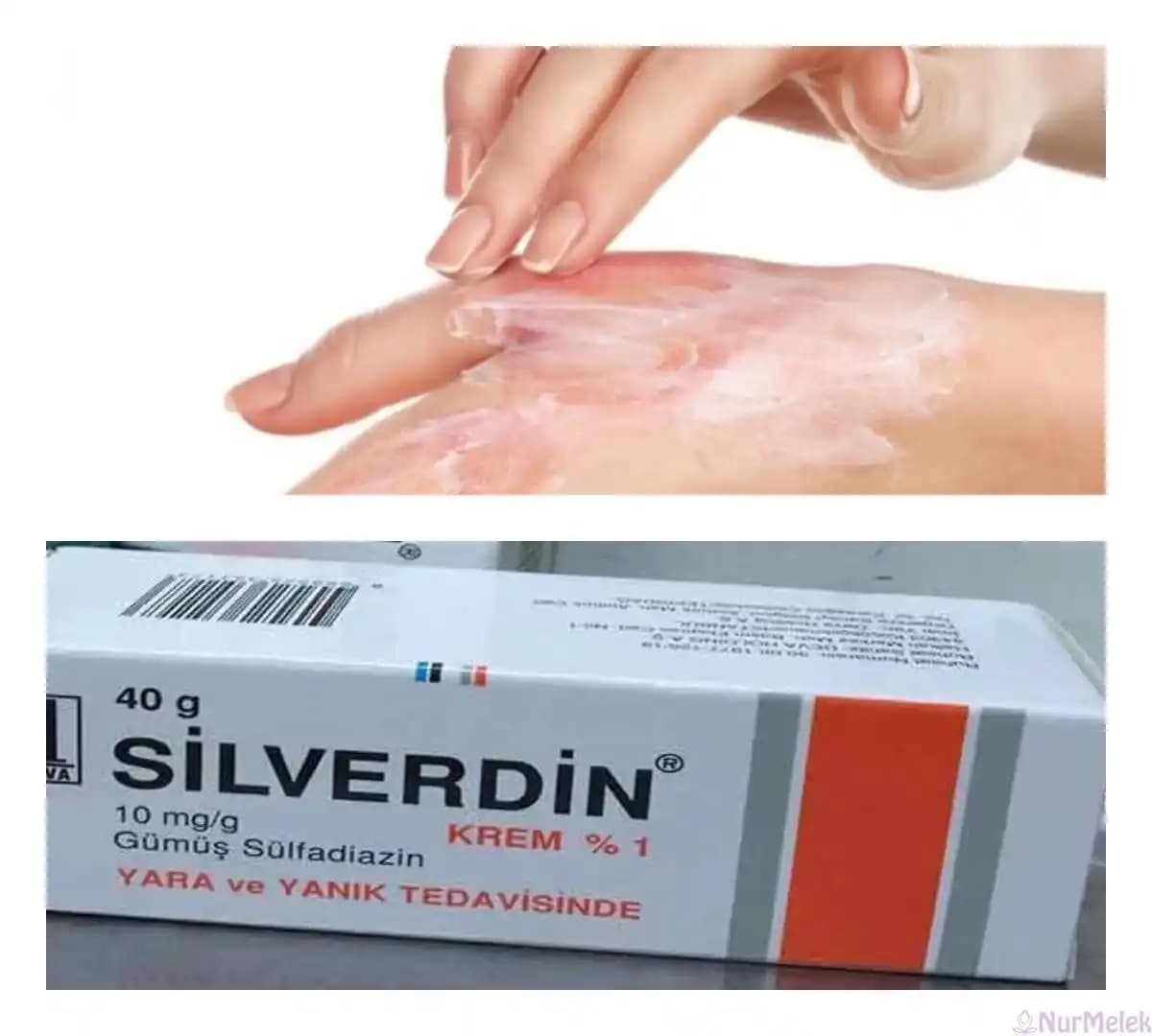 Yanık İzlerine Karşı Etkili Çözümler ve Kozmetik Sektöründeki Güncel Gelişmeler