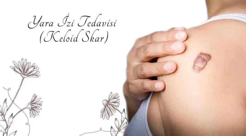 Yara İzi Tedavisinde Etkili Yöntemler ve Estetik Çözümler Hakkında Bilgiler