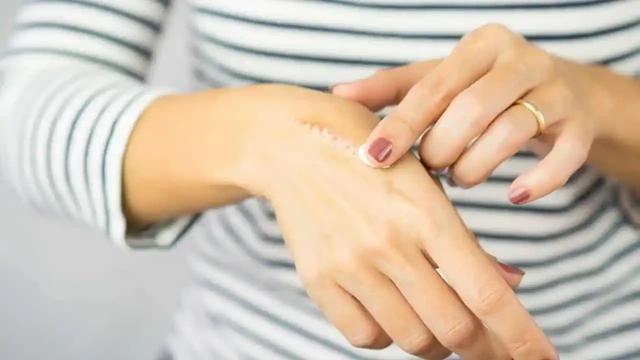 Yara İzleri Nasıl Giderilir: Etkili Yöntemler ve Uzman Tavsiyeleri