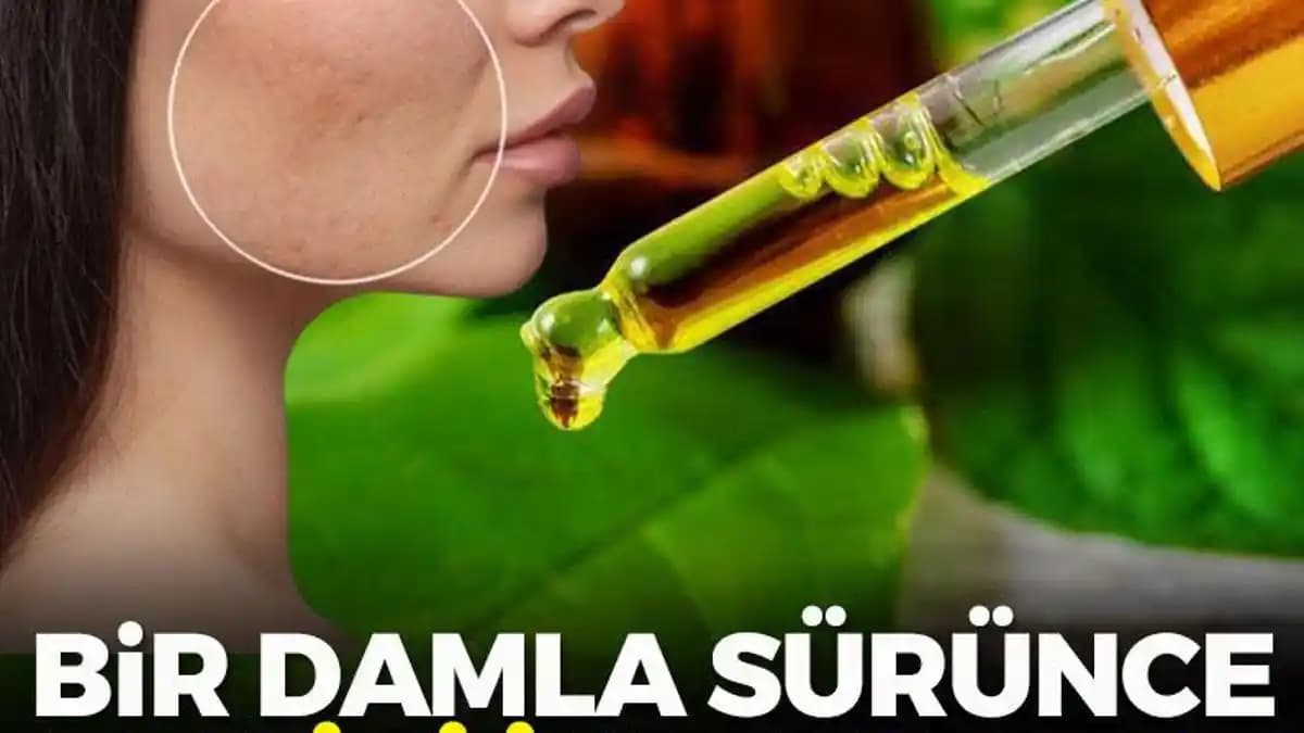 Yara Lekeleri İçin Güncel Kozmetik ve Doğal Çözüm Yöntemleri