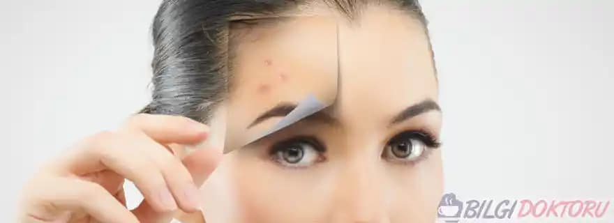 Yeni Çıkan Sivilceleri Engelleme ve Cilt Sağlığını Koruma Yöntemleri