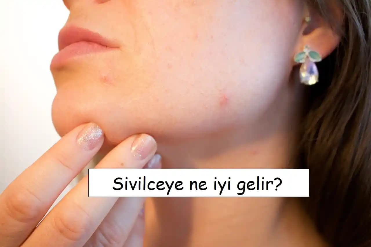 Yeni Çıkmaya Başlayan Sivilcelere Karşı Etkili Çözüm Yöntemleri ve Cilt Bakım İpuçları