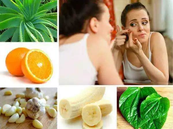 Yetişkin Aknesi ve Güncel Kozmetik Yaklaşımlar: Nedenleri ve Etkili Çözümler