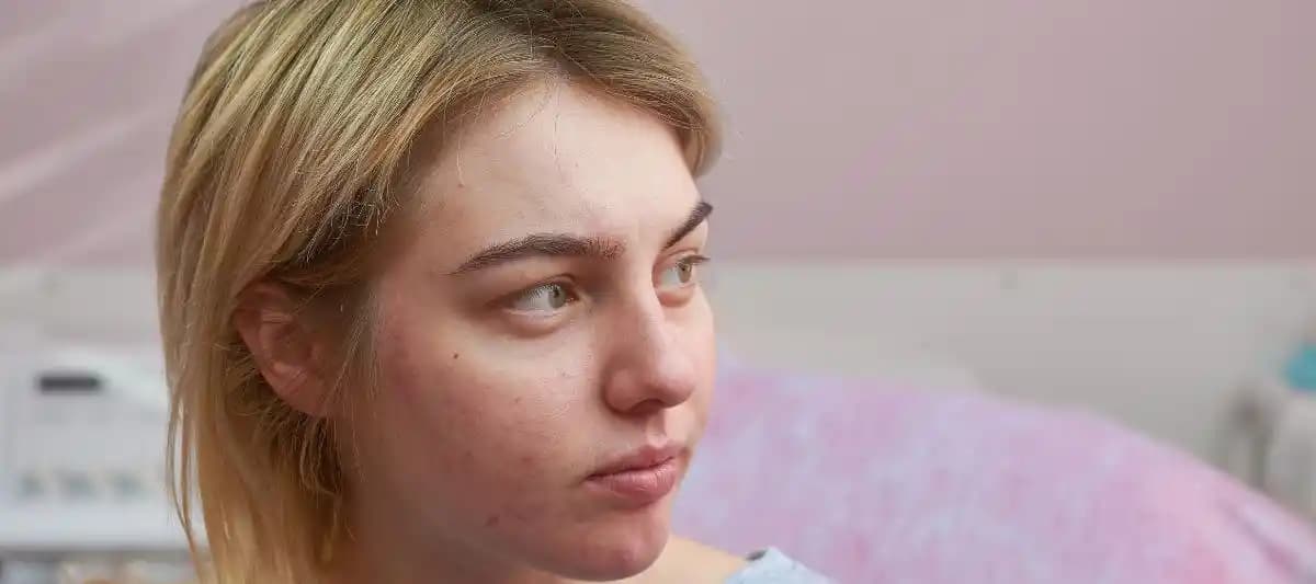 Yıllar Süren Sivilceler İçin Nedenler ve Etkili Tedavi Yöntemleri