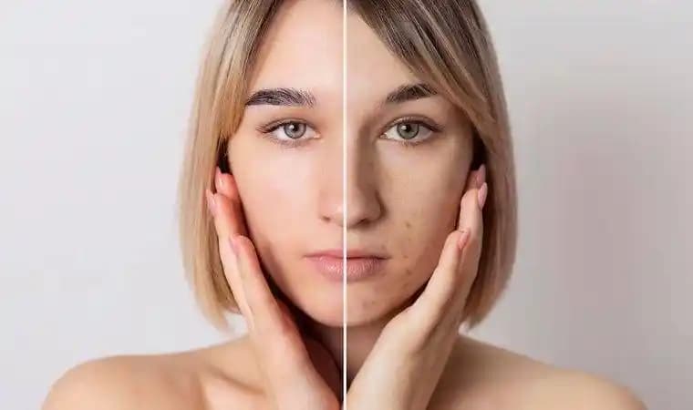 Yıpranmış Cilt Nasıl Onarılır ve Sağlıklı Görünüm Nasıl Kazanılır