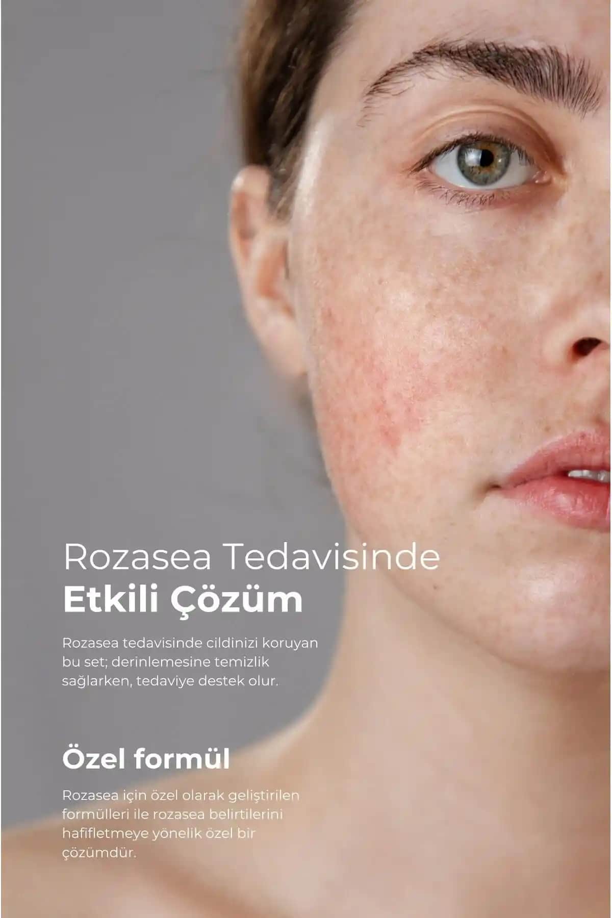 Yoğurdun Cilt Bakımındaki Faydaları ve Doğal Güzellik İçin Kullanım Yöntemleri