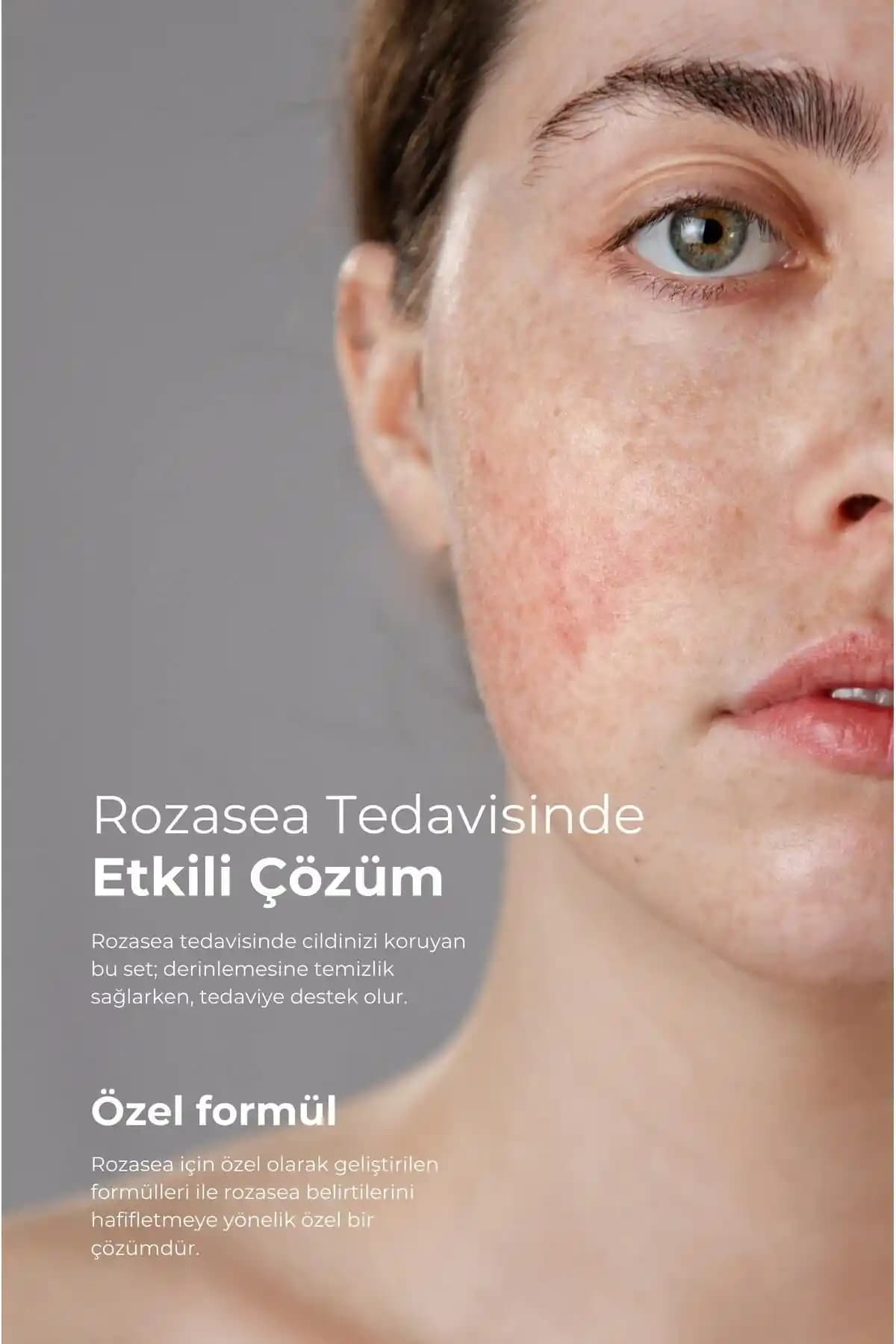 Yoğurdun Cilt Bakımındaki Faydaları ve Doğal Güzellik İçin Kullanım Yöntemleri