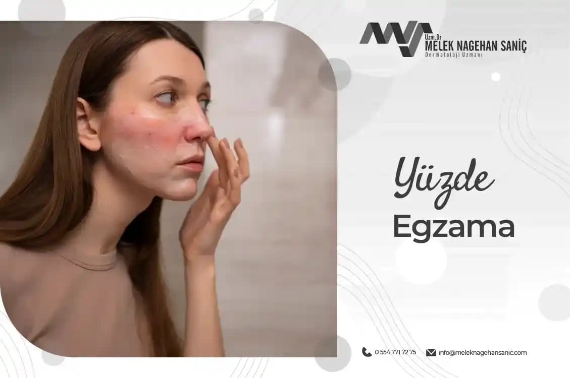 Yüz Egzaması Nedir, Belirtileri ve Etkili Bakım Yöntemleri Hakkında Bilgiler