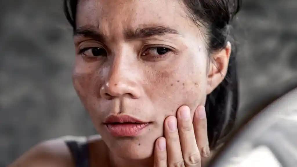 Yüz Kararmasının Nedenleri ve Kozmetik Yaklaşımlar: Etkili Çözüm Yolları