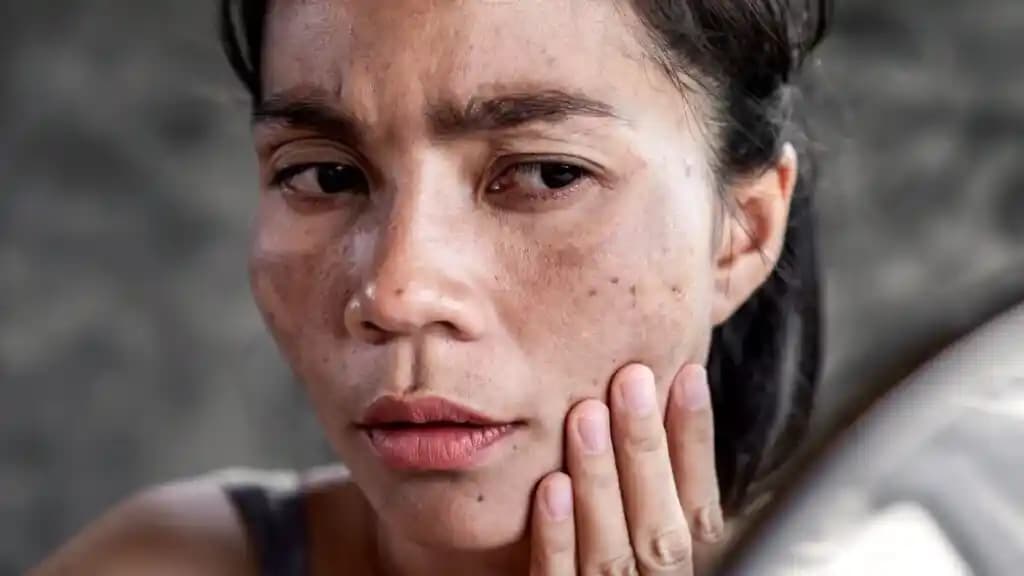 Yüz Kararmasının Nedenleri ve Kozmetik Yaklaşımlar: Etkili Çözüm Yolları