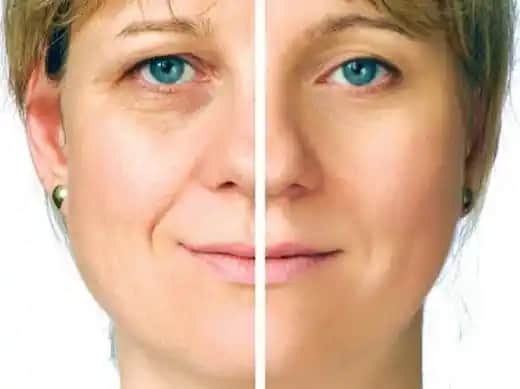 Yüz Kırışıklarına Karşı Doğal ve Bitkisel Çözüm Yöntemleri ve Güvenilir Alternatifler