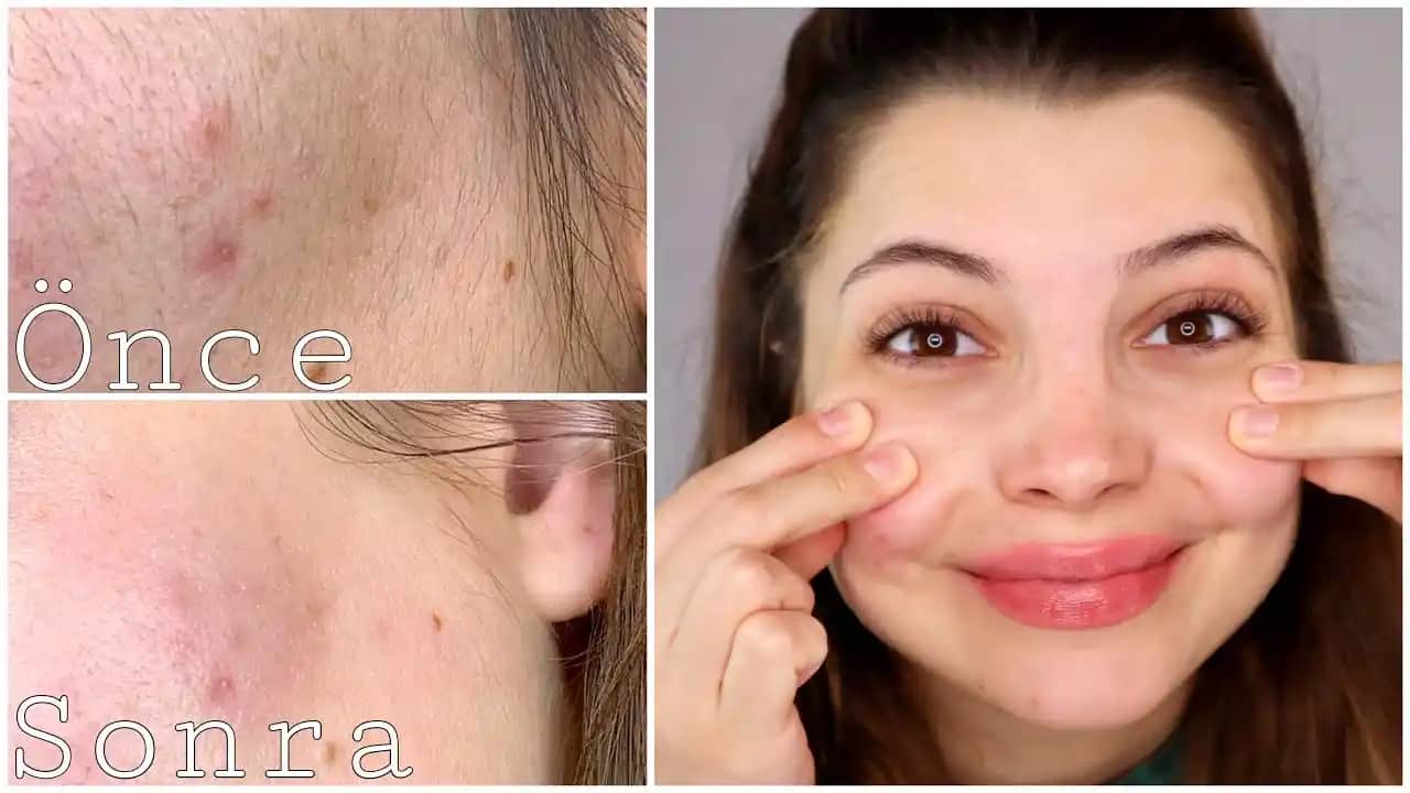 Yüz Tüylerini Sarartma Yöntemleri ve Güvenlik İpuçları Hakkında Bilgiler