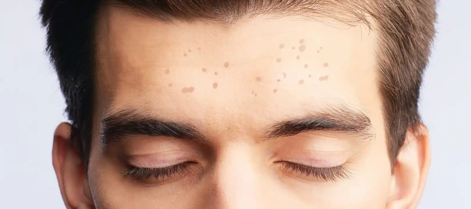 Yüzde Çil Nasıl Geçer Gelişmiş ve Güvenli Yöntemler Hakkında Detaylı Bilgi