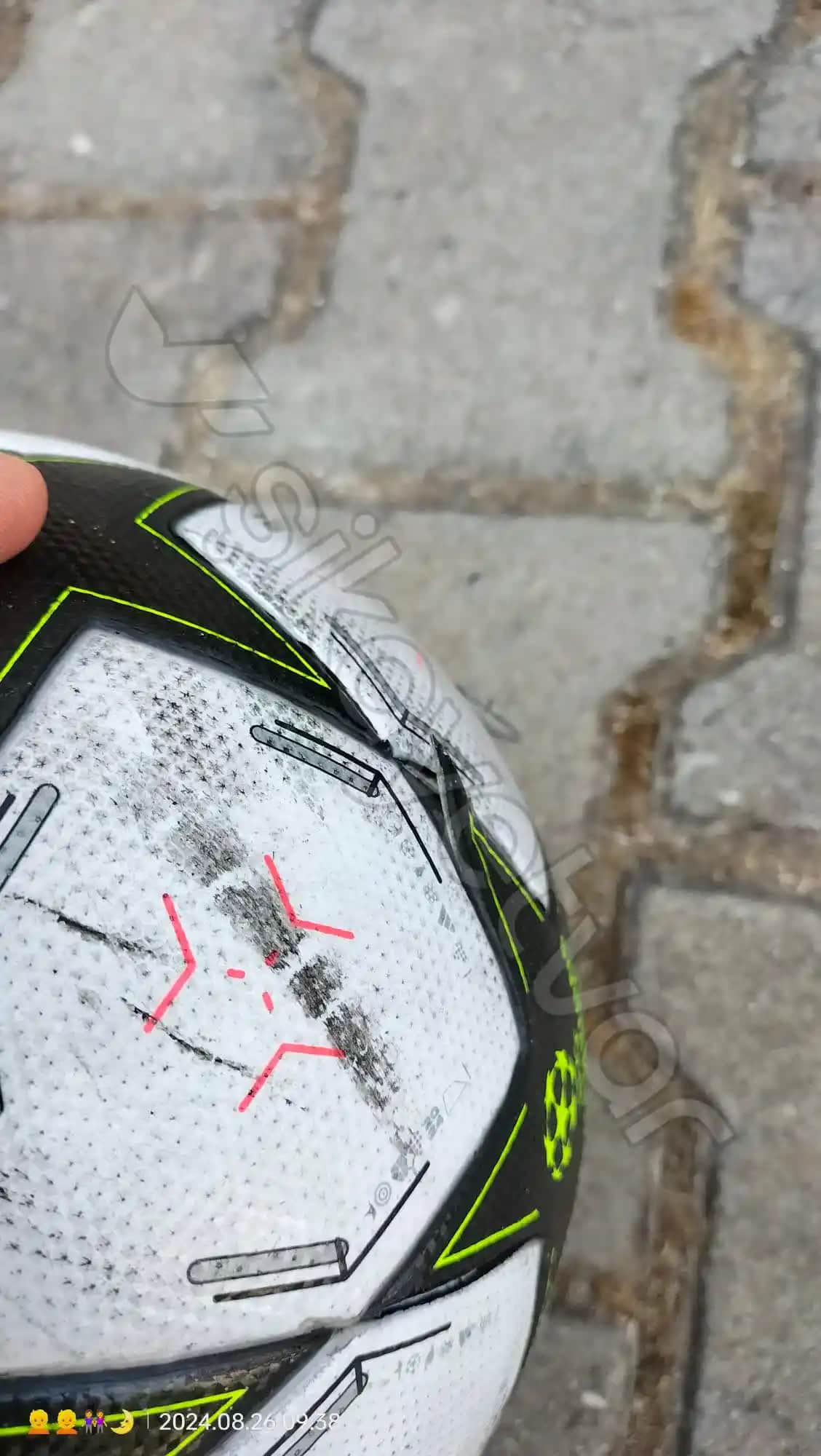 Yüzde Kabuk Atmasının Nedenleri ve Doğru Bakım Yöntemleri Hakkında Detaylı Bilgi