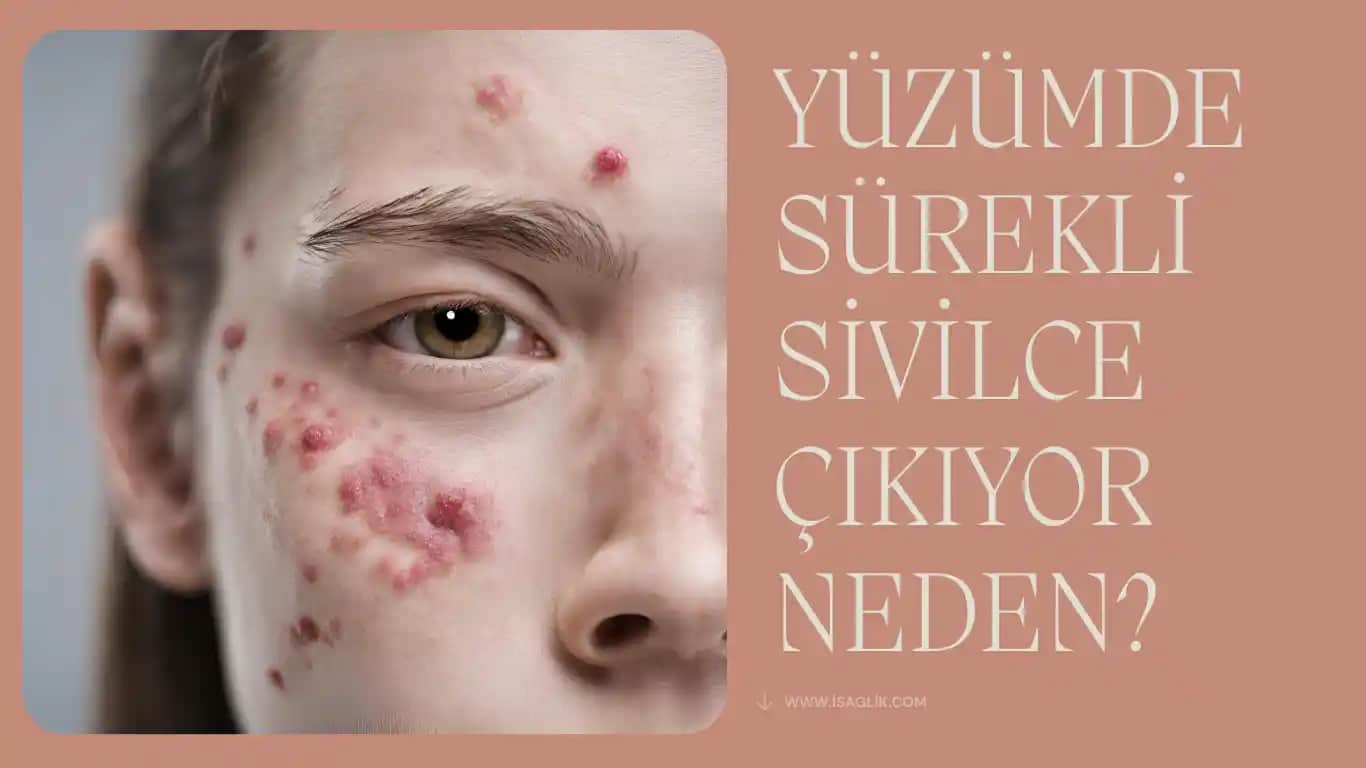 Yüzde Sivilce Nedenleri ve Etkili Çözüm Yolları Hakkında Kapsamlı Rehber