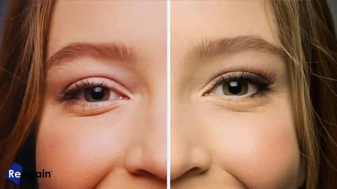 Yüzde Ton Eşitsizliği Nedenleri ve Çözüm Yolları Hakkında Kapsamlı Bilgi