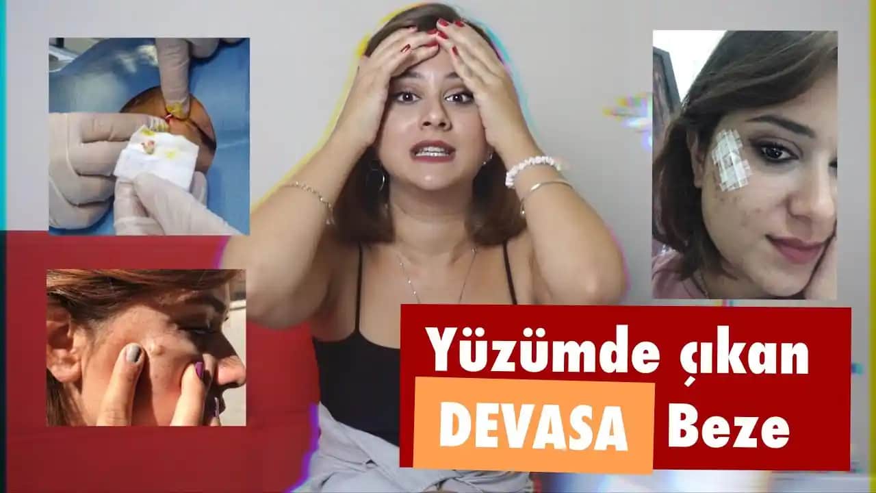 Yüzde Yağ Bezesine Karşı Bilinçli Yaklaşımlar ve En Etkili Tedavi Yöntemleri