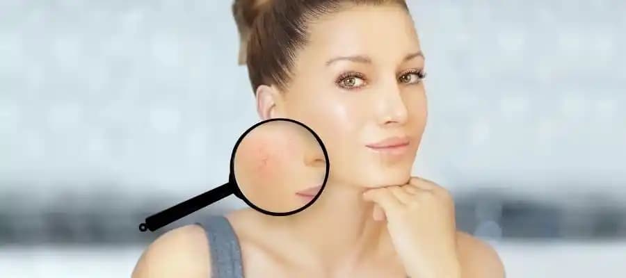 Yüzde Yanma Hissi Nasıl Geçer: Etkili Cilt Rahatlatıcı Yöntemler ve İpuçları